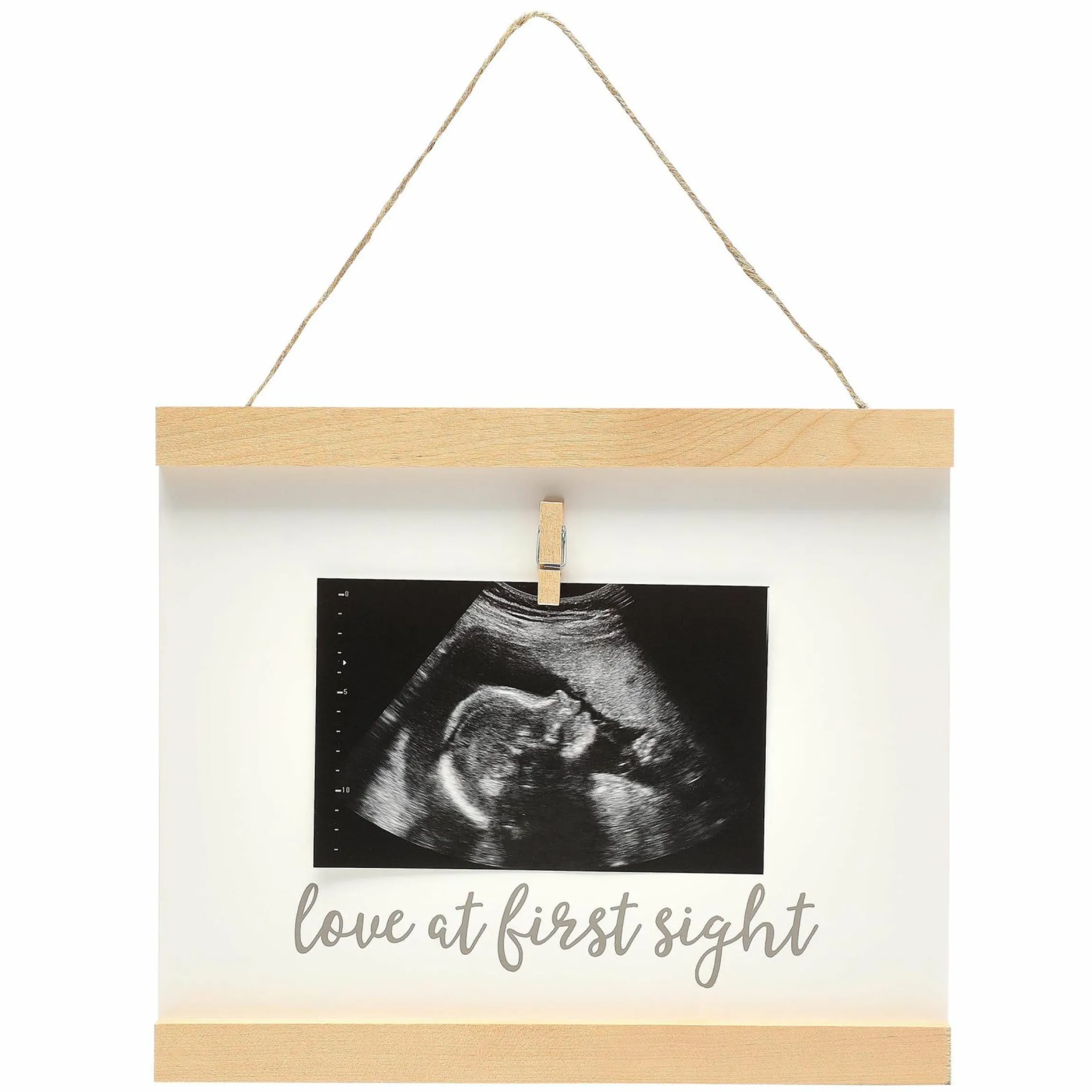 Wandbehang für Ultraschallbild - Love at first sight